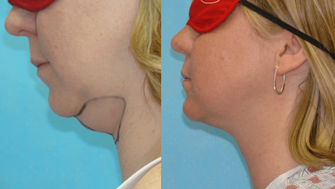 Celine Aesthetic Medicine - Cosmetic & Aesthetic Services Clifton Park, NY